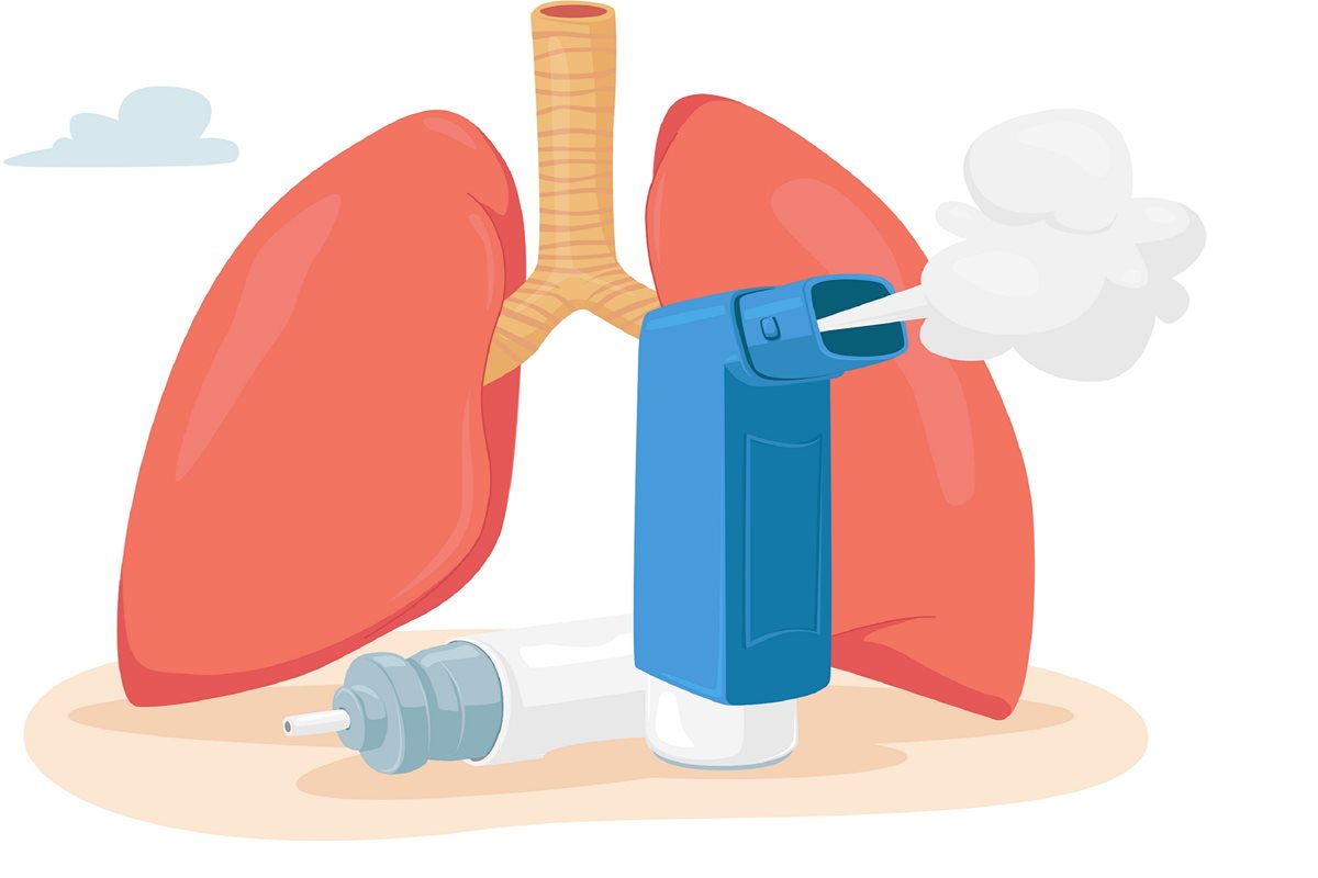Astma oskrzelowa u dziecka czym się Publikacja Adamed Expert