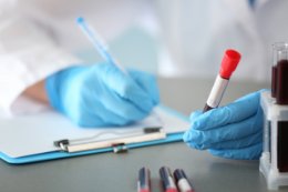 Gazometria krwi tętniczej - jak ją wykonać?