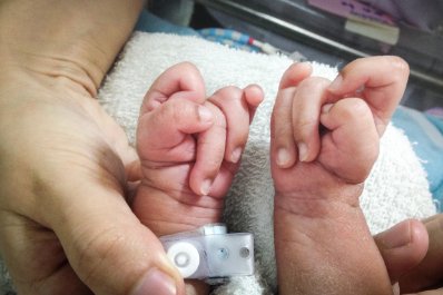 Zespół Edwardsa – czym jest i jaki ma wpływ na dziecko?