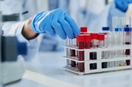 Badania laboratoryjne w "Moim Zdrowiu"