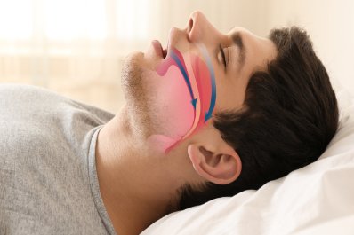 Ekspertka: nawet 20 proc. Polaków może mieć bezdech senny