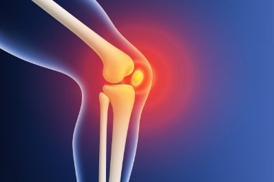 Choroba zwyrodnieniowa stawów w gabinecie lekarza POZ