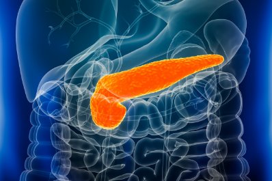 Pacjent z przewlekłym zapaleniem trzustki w gabinecie lekarza POZ – kompendium diagnostyczno-terapeutyczne w świetle wytycznych HaPanEU i ESPEN