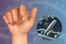 Grzybice skóry gładkiej, stóp i paznokci