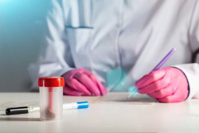 Badanie kału - wszystko, co musisz wiedzieć