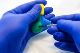 Lekarze: rośnie liczba pacjentów z akromegalią, rozpoznanie wciąż bywa opóźnione