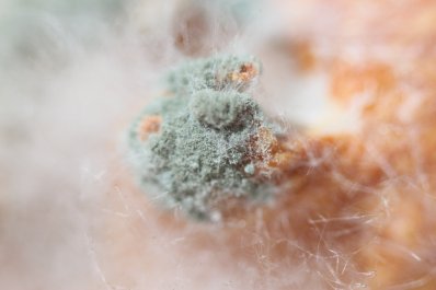 Poważne grzybice w Polsce - nowe dane pokazują skalę porównywalną z chorobami cywilizacyjnymi