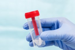Krew utajona w kale (test iFOBT/FIT) – co warto wiedzieć?