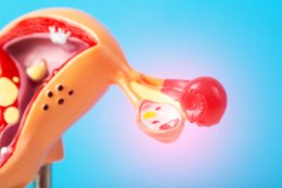 Ginekolog: chirurgia pozostaje fundamentem leczenia raka jajnika