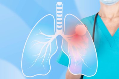 WHO: zapalenie płuc najpoważniejszą zakaźną przyczyną śmierci na świecie w 2024 r.