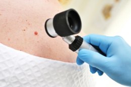 Czerniak – ścieżka diagnostyczna. Kluczowe badania