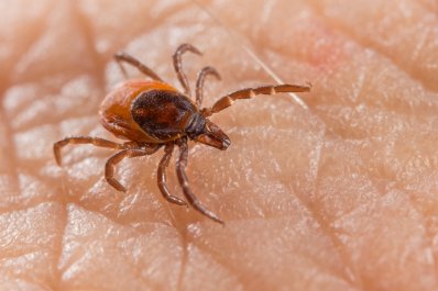 Neuroborelioza – przyczyny, objawy, diagnostyka, leczenie