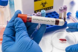 Lipoproteina (a) – badanie, normy, co oznacza wysoki poziom
