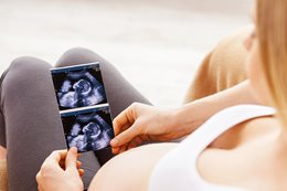 Case study: pacjentka w ciąży w aptece