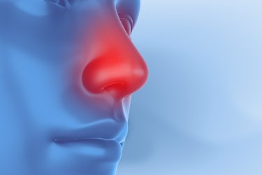 Alergie w aptece – między mitami a nowymi wytycznymi 