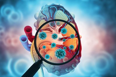 Przewlekła choroba nerek - o czym powinien pamiętać lekarz POZ?