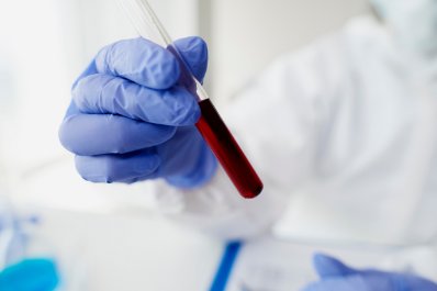 Morfologia z rozmazem – normy i wyniki badania krwi