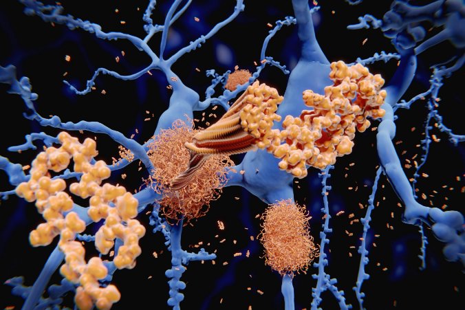 NFZ w Światowym Dniu Walki z Chorobą Alzheimera: ryzyko zachorowania wzrasta z wiekiem