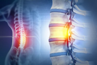 Przegląd badań stosowanych w neurologii – badanie płynu mózgowo-rdzeniowego