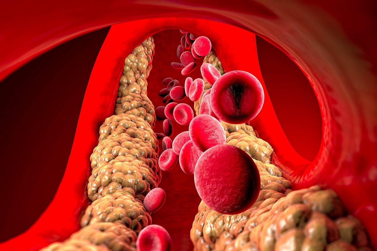 Cholesterol (całkowity, HDL, LDL) - Publikacja | Adamed Expert