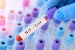 Test na HIV – co warto wiedzieć