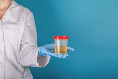 Dobowa zbiórka moczu – na czym polega to badanie?