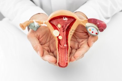 Prof. Paszkowski: mięśniaki macicy to najczęstsza przyczyna anemii u kobiet