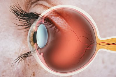 Czym jest retinopatia cukrzycowa i jak się jej wystrzec?