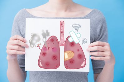 Badania przesiewowe w kierunku raka płuc