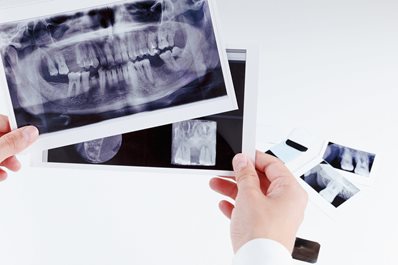 Pantomogram – zdjęcia radiologiczne w stomatologii