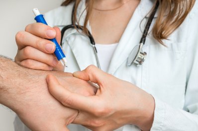 Choroby odkleszczowe: borelioza i KZM po ukąszeniu kleszcza – różnice i ryzyko zakażenia