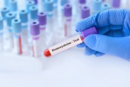 Homocysteina - czym jest i jak obniżyć jej poziom?