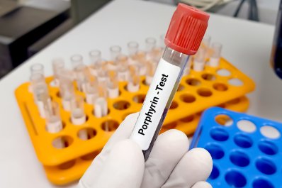 Porfiria – co to za choroba? Objawy, diagnostyka, leczenie